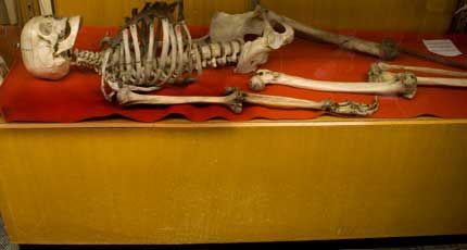 Скелет Джеффа Дэвиса