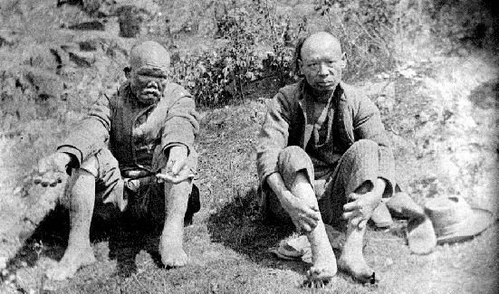 Китайские прокажённые в 1890-х годах
