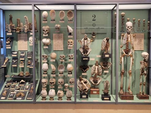 Коллекция скелетов
