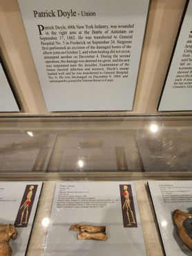 Ребро Патрика Дойла