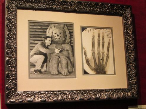 Рентгеновский снимок пули в руке Гудини