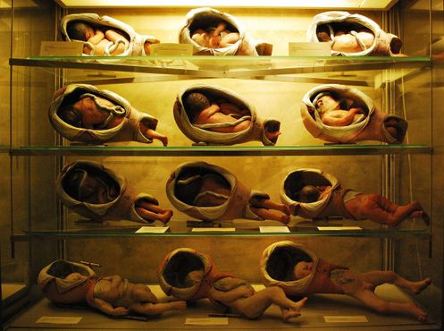 Акушерские модели, иллюстрирующие процесс родов