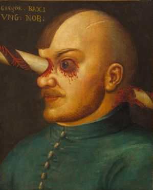 Картина венгерского дворянина Грегора Бачи, вылеченного после того, как копьё насквозь проткнуло его правый глаз во время турнира