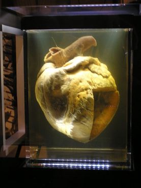 Сердце Фар Лэпа в Национальном музее Австралии