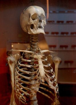 Скелет в "Эфирном куполе"