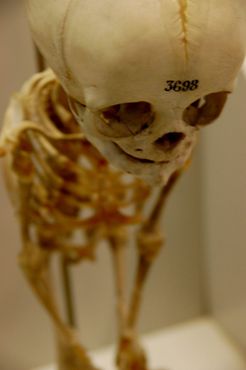 Сгорбленный скелет