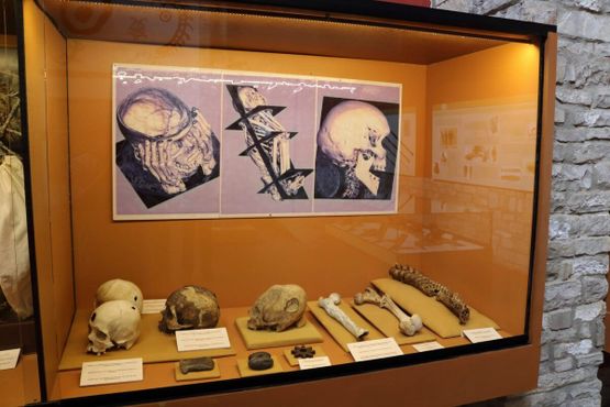 Кости и трепанированные черепа в Лагуна-де-лос-Кондорес