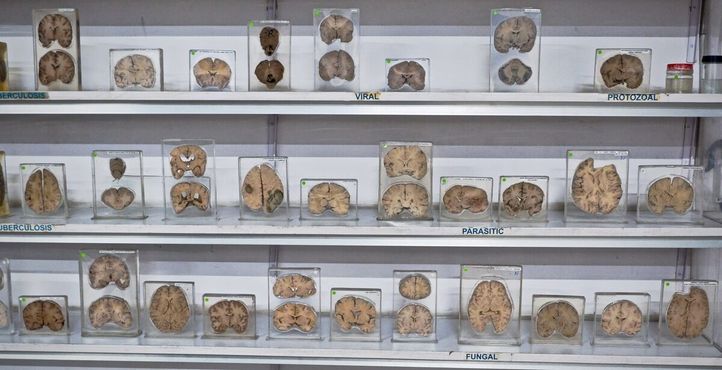 Множество образцов мозга на выставке