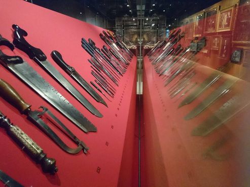Коллекция ампутационных инструментов разных веков 