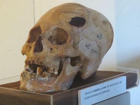 Один из черепов в антропологическом музее Лимы 