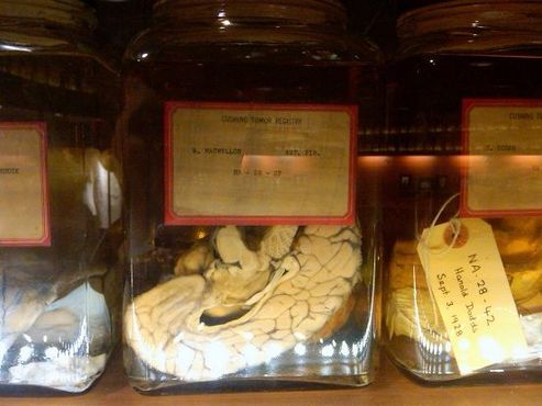 Коллекция человеческих мозгов Кушинга